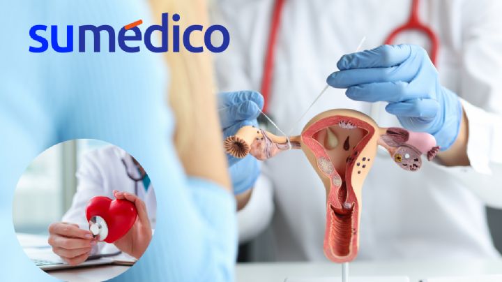 ¿Qué relación tiene la ligadura de trompas de Falopio con las enfermedades cardiovasculares?