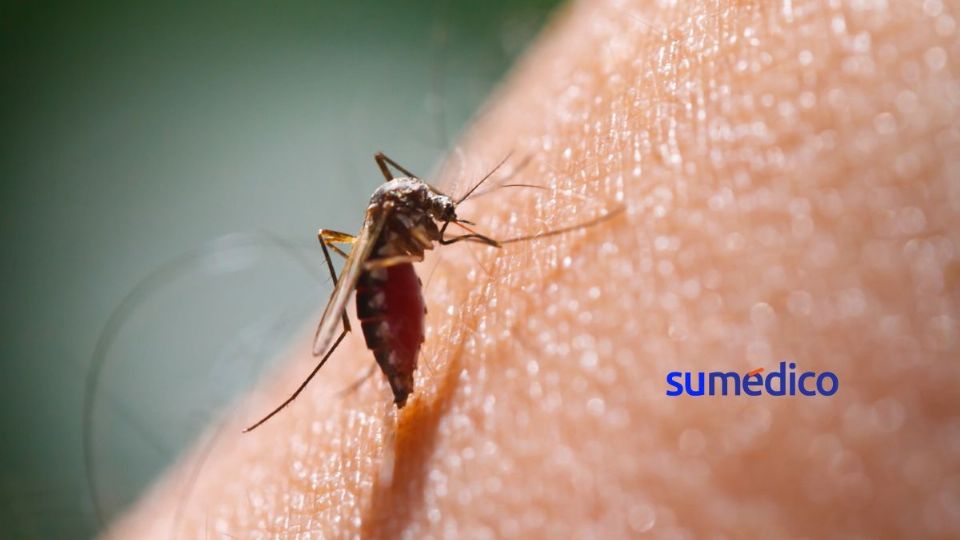 Puedes aliviar la picadura de mosquitos con estos remedios.