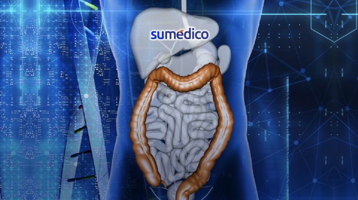Enfermedad Inflamatoria Intestinal: Así afecta a jóvenes de 20 a 35 años