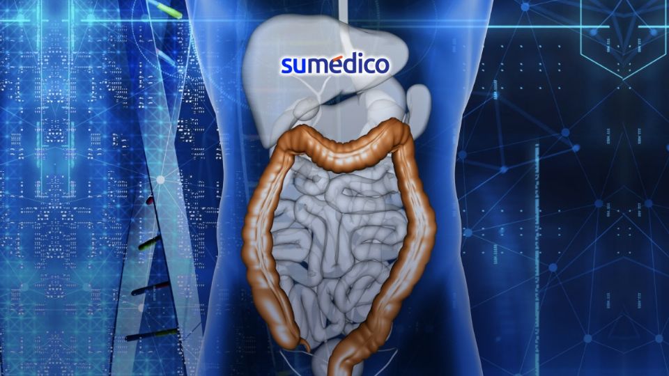 Las enfermedades Inflamatorias intestinales son un mal incurable pero tratable.