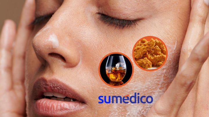 5 hábitos alimenticios que dañan tu piel