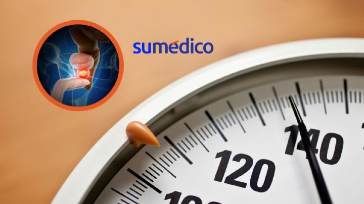 Subir de peso incrementa hasta un 27% cáncer de próstata fatal, según estudio