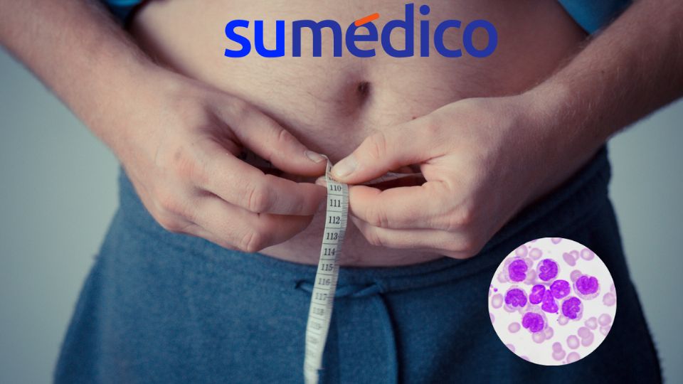 La obesidad puede generar problemas graves de salud.