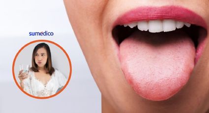 ¿Sensación de lengua quemada? Por qué pasa y cómo aliviarla