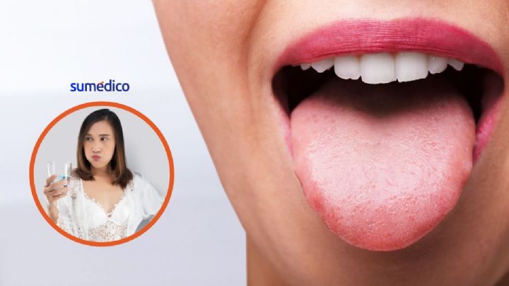 ¿Sensación de lengua quemada? Por qué pasa y cómo aliviarla