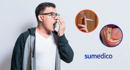 ¿Tienes mal aliento y no sabes por qué? Podría tratarse de halitosis