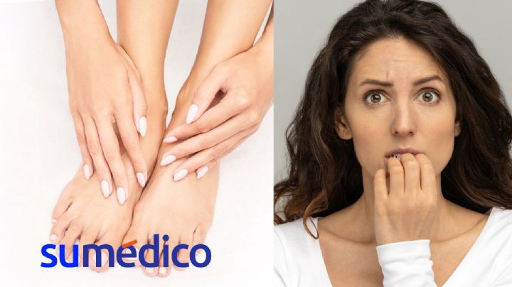¿Manchas blancas en las uñas? Conoce sus razones