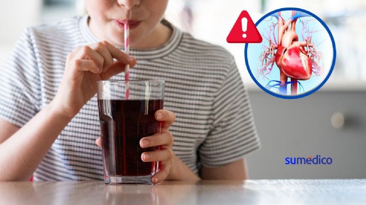Así afecta al corazón de niños el consumo excesivo de azúcares