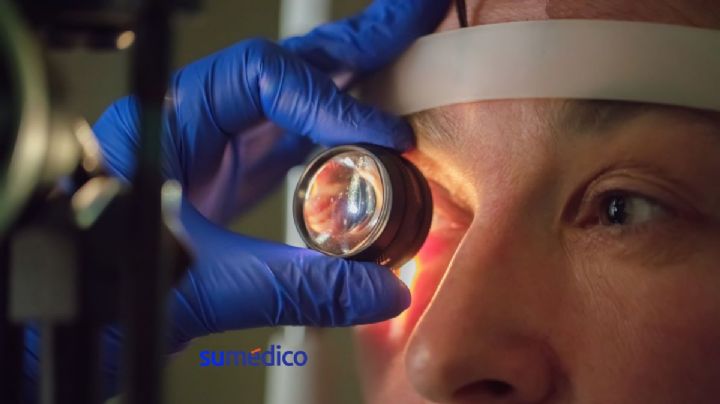 Glaucoma, segunda causa de ceguera en el mundo