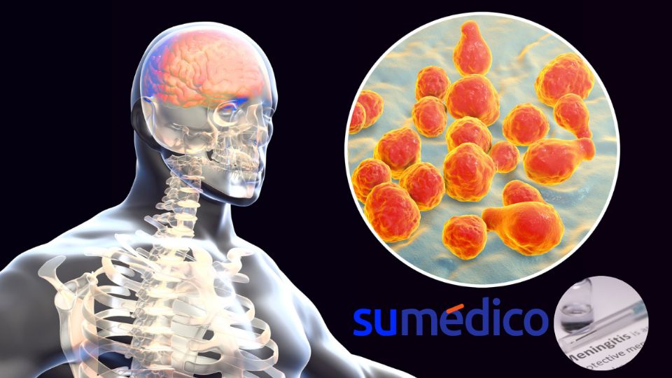 La meningitis es un problema grave de salud.