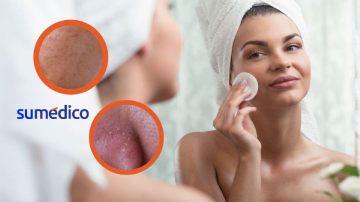 5 errores al desmaquillarte. Conoce cómo afecta tu salud en la piel