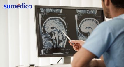 Estos son los 17 síntomas de los tumores en el cerebro, ¿los conoces?