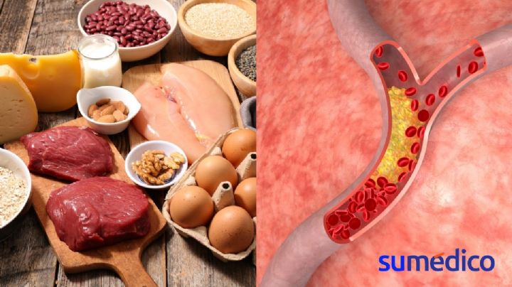 ¿Tienes el colesterol alto? Nunca comas estos alimentos