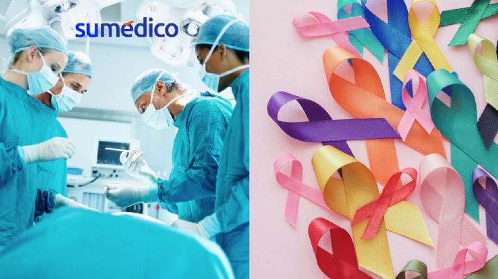 Esta cirugía puede reducir riesgo de cáncer en personas con obesidad