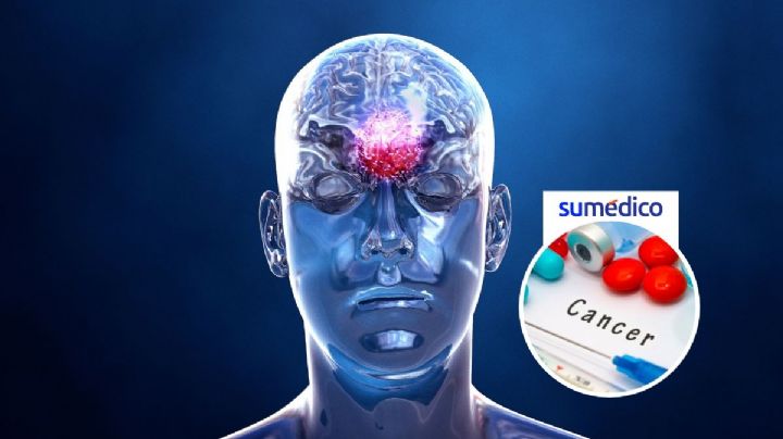 Por primera vez, quimioterapia logra adentrarse al cerebro para contratacar tumores