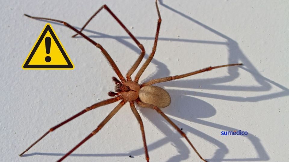 El veneno de araña violinista tiene efecto 10 veces más potente que una quemadura con ácido sulfúrico.