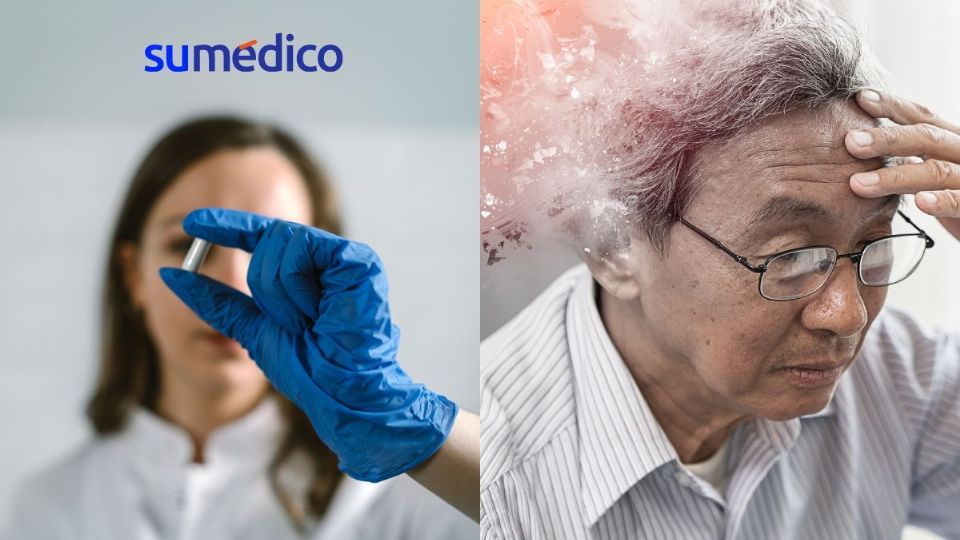 Según informa la Secretaría de Salud, se estima que en México aproximadamente un millón 300 mil personas padecen la enfermedad de Alzheimer.