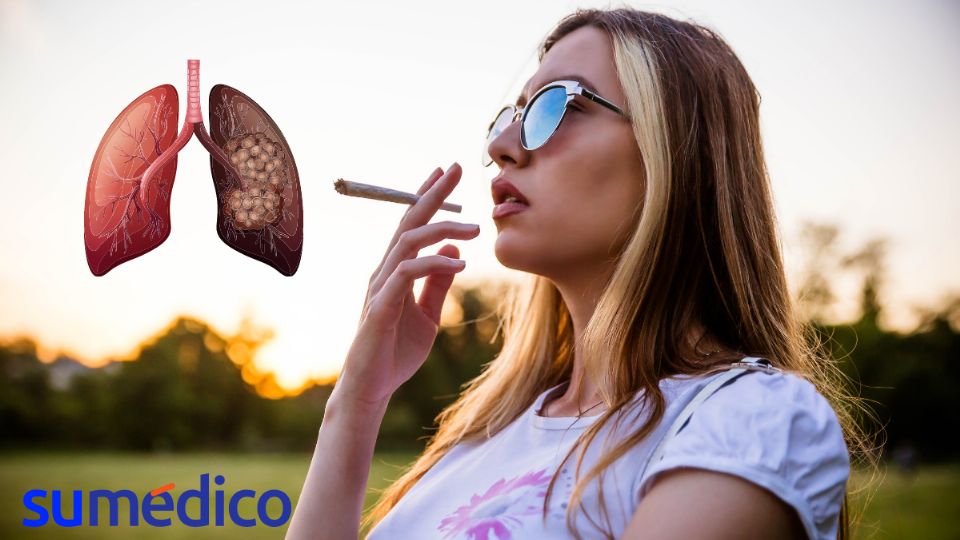 El humo del cigarro es el principal culpable del cáncer de pulmón.