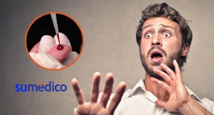 ¿Tienes miedo a la sangre? Conoce la hematofobia