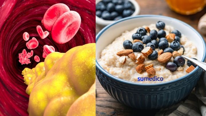 Así debes comer avena para reducir los triglicéridos