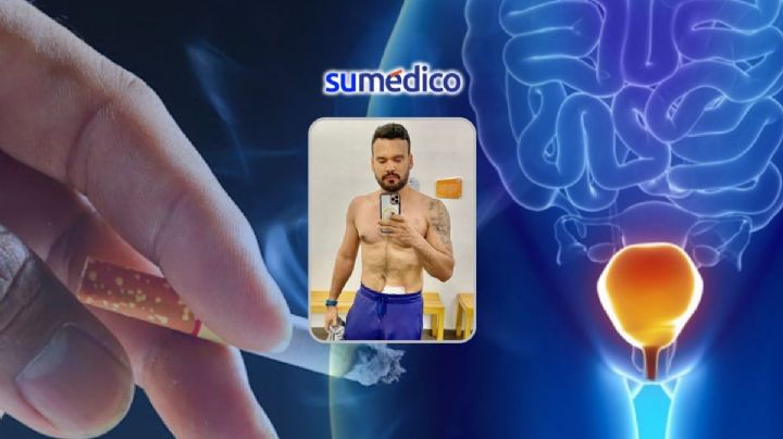 El 50% de los casos de cáncer de vejiga están relacionados con el tabaquismo