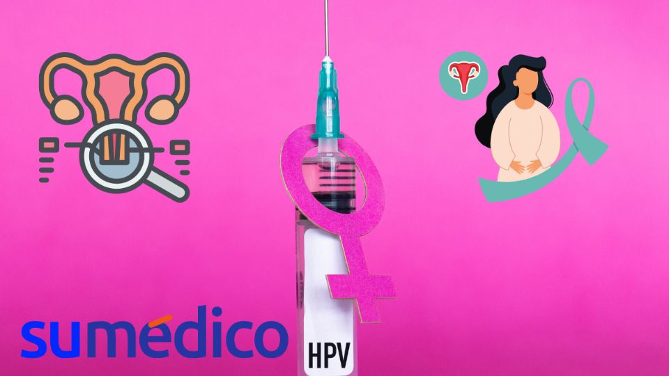 La vacuna contra el VPH ayuda a prevenir el cáncer cervicouterino.