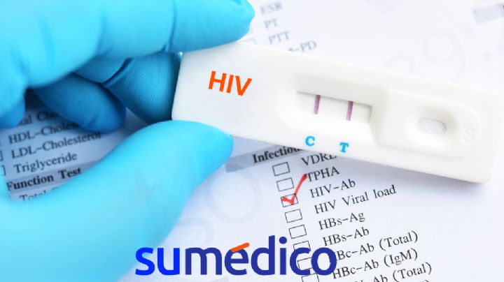 ¿Por qué es importante hacerse la prueba del VIH y dónde hacerla gratis en CDMX?