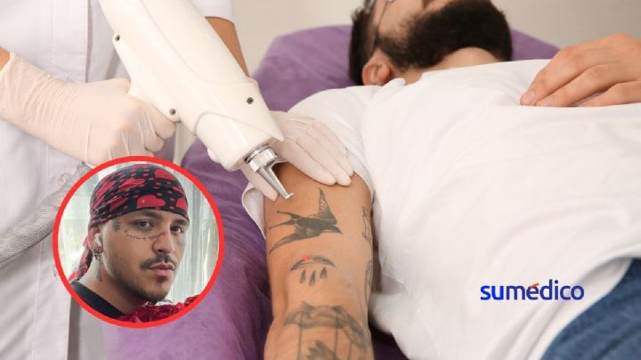 Christian Nodal: ¿Cómo será el procedimiento para remover los tatuajes de su cara?