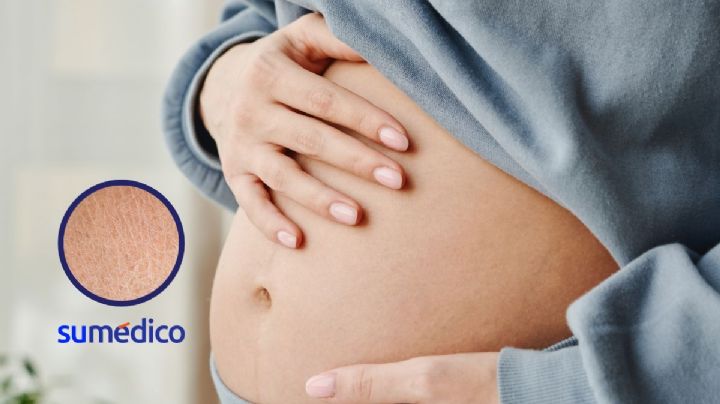 5 consejos para evitar la sequedad en piel, labios y boca durante el embarazo