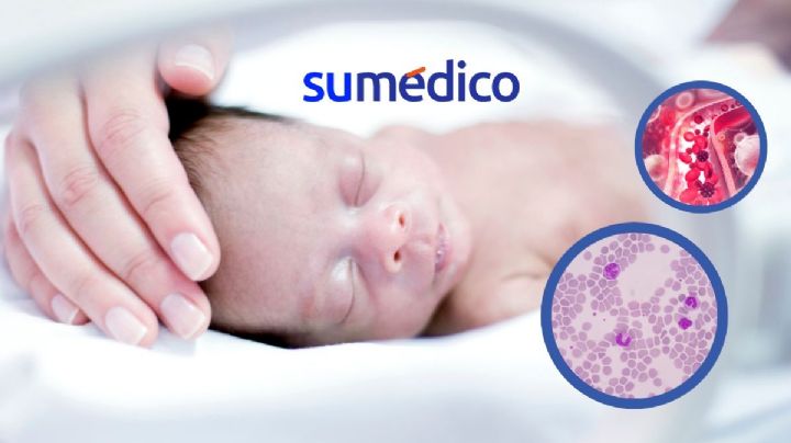 Bacterias en la sangre de bebés prematuros tiene origen en el microbioma intestinal, según estudio.
