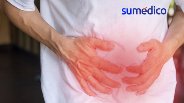 ¿El síndrome de intestino irritable se puede curar? Esto dicen expertos
