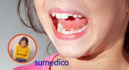 ¿Tienes los dientes desalineados? Puedes desarrollar estos 5 problemas