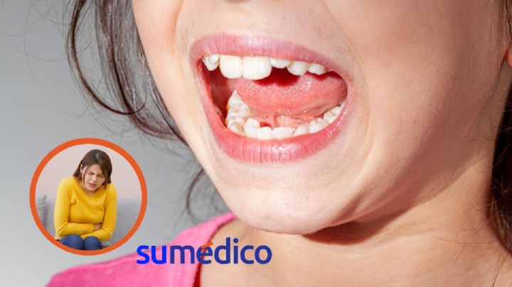 ¿Tienes los dientes desalineados? Puedes desarrollar estos 5 problemas