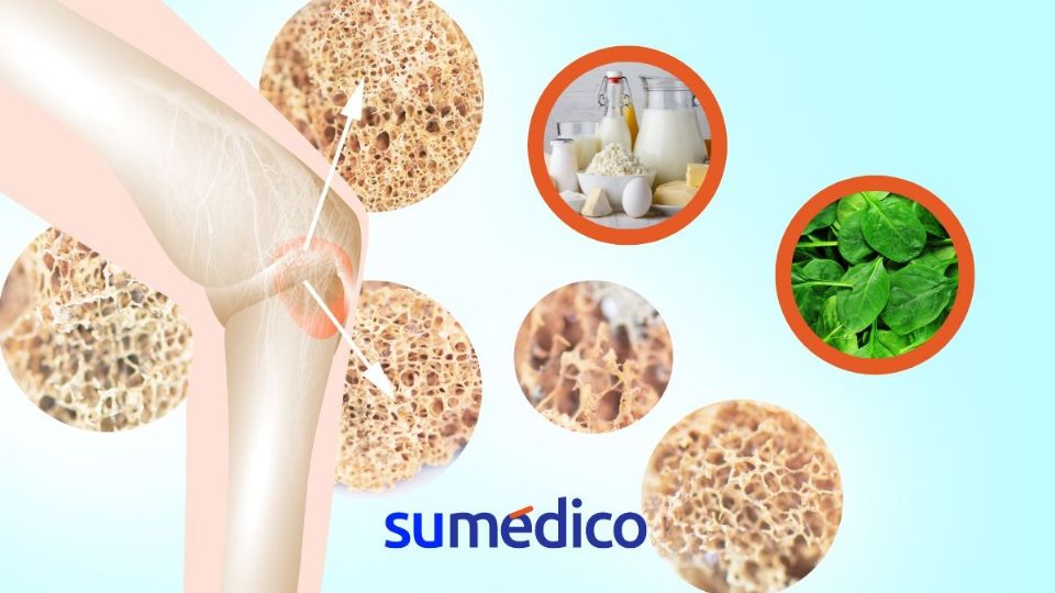 Alimentos que puedes añadir en tus cenas y fortalecerán tus huesos debido a su contenido en vitaminas y nutrientes.