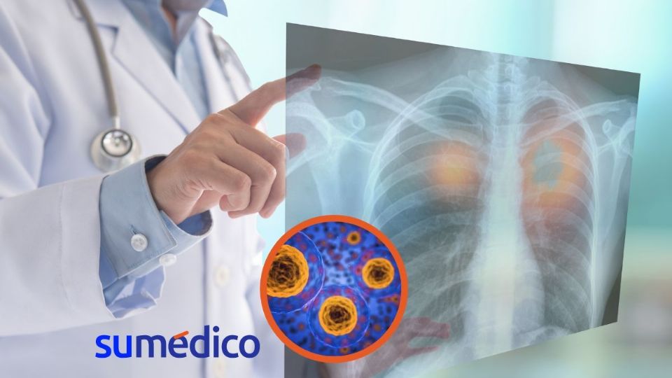 ¿Cuál es la relevancia del primer atlas pulmonar?