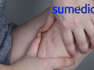 Cortisol elevado favorece la celulitis