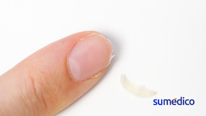 ¿Uñas quebradizas y piel seca? Este mineral sería el responsable