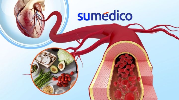 5 alimentos para incluir en la cena y limpiar las arterias