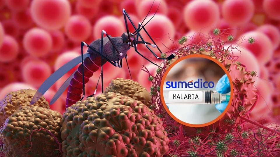 ¿Cómo afecta la malaria al cuerpo? Un nuevo sensor probablemente tenga la posibilidad de detener su transmisión.