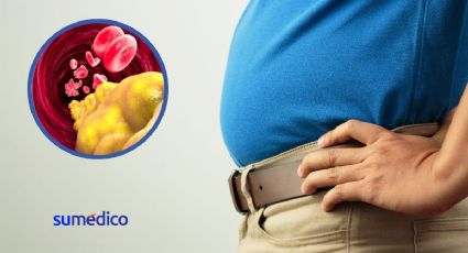 Metabolismo de las grasas ¿cómo cambia a partir de los 50?