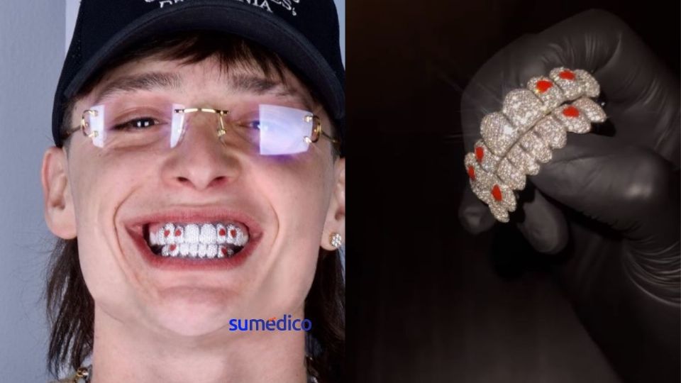 Los dientes del cantante Peso Pluma lucen brillantes y con figuras de corazones.