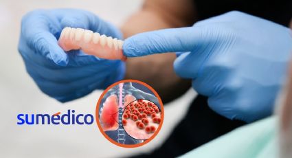 Falta de limpieza en la dentadura postiza podría relacionarse con neumonía, estudio