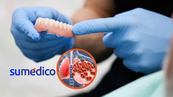 Falta de limpieza en la dentadura postiza podría relacionarse con neumonía, estudio
