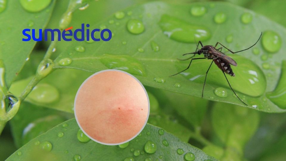 ¿Cansado de los mosquitos? Checa si no tienes estas plantas en tu casa.