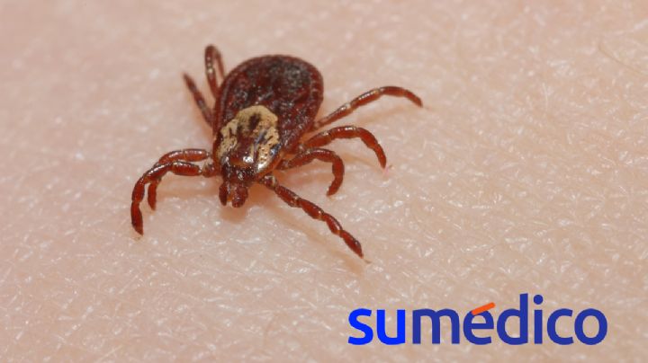 ¿Qué es el virus de la Oz que ya causó una muerte en Japón?