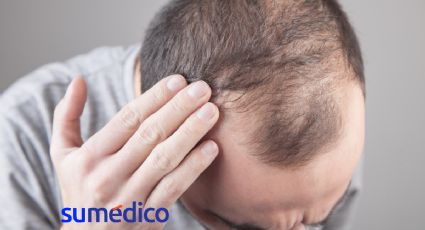 ¿Cuál es el medicamento contra la alopecia que aprobó la FDA?