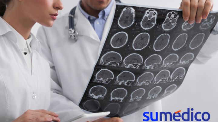 Encuentran variante genética de esclerosis múltiple ¿estamos cerca de un tratamiento?