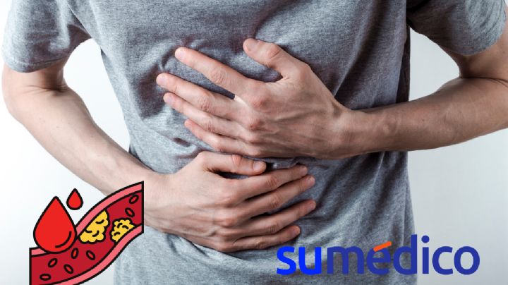 ¿La colitis puede provocar problemas de colesterol en las personas?