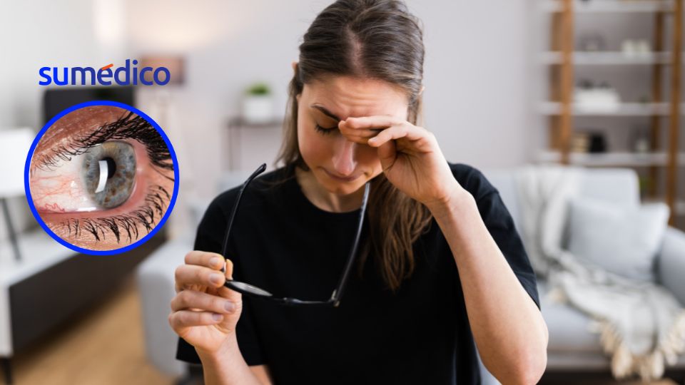Las alergias por calor pueden llegar a ser peligrosas
