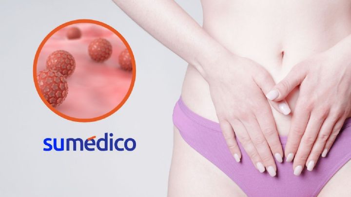 “Mi mente quedó en blanco al conocer el resultado”: retos ante el Virus del Papiloma Humano